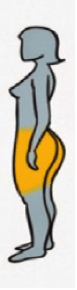 Obesidade glútea